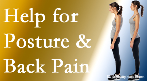 Poor posture and back pain are linked and find help and relief at Dr. Butwell.