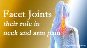Dr. Butwell thoroughly examines, diagnoses, and treats cervical spine facet joints for neck pain relief when they are involved.