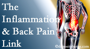 Dr. Butwell addresses the inflammatory process that accompanies back pain as well as the pain itself.