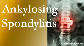 Ankylosing spondylitis is gently cared for by your Georgetown chiropractor.