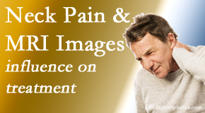 Dr. Butwell considers MRI findings like Modic Changes when setting up a neck pain relieving treatment plan.