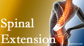Dr. Butwell understands the role of extension in spinal motion, its necessity, its benefits and potential harmful effects. 