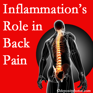 The role of inflammation in Georgetown back pain is real. Chiropractic care can manage it.
