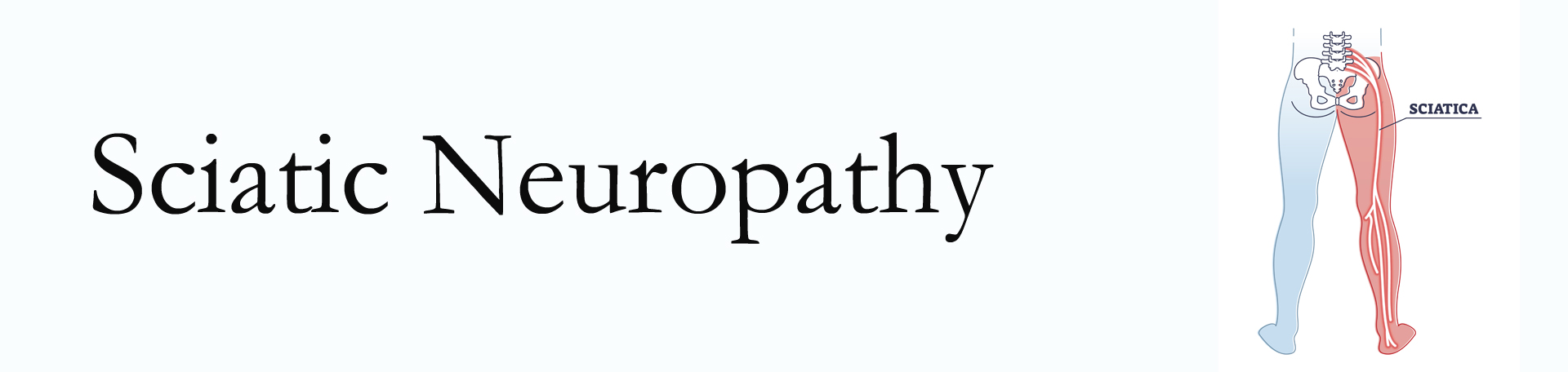 Georgetown neuropathy pain (sciatica) 
