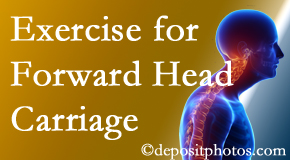 Georgetown chiropractic treatment of forward head carriage is two-fold: manipulation and exercise.