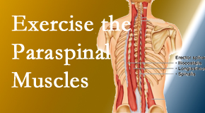Dr. Butwell describes the importance of paraspinal muscles and their strength for Georgetown back pain relief.