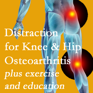 A chiropractic treatment plan for Georgetown knee pain and hip pain caused by osteoarthritis: education, exercise, distraction.