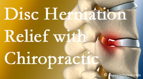 Dr. Butwell gently treats the disc herniation causing back pain. 